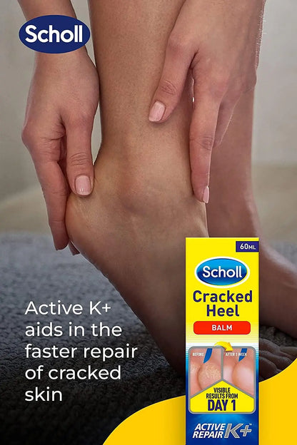 Scholl Cracked Heel Skin Repair Balm Cream 60ml